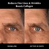pdrn salmon serum